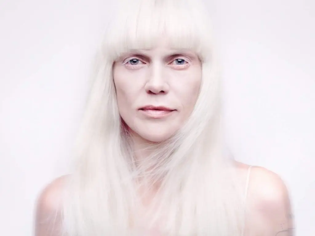 anna loos